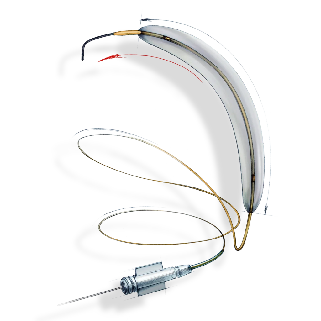 Venous Remodelling Balloon