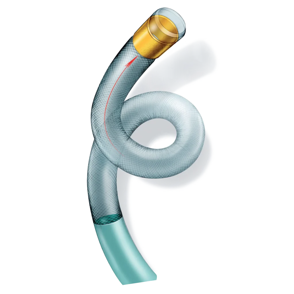 Guiding Catheter